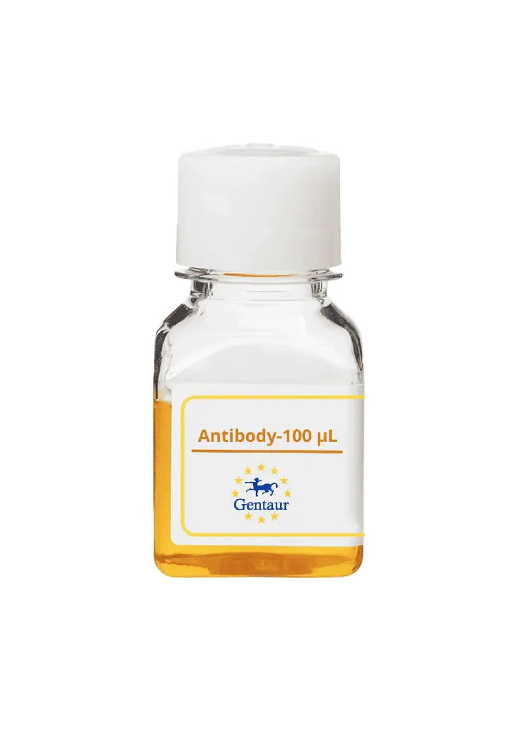 ALKBH4 Antibody   