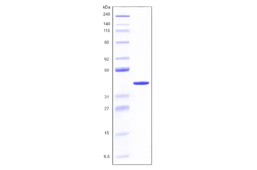 [MC03-050] Recombinant Human Galectin 8, variant 1, His Tag (317 a.a.) -50 ug