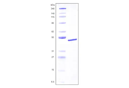 [MC04-025] Recombinant Human Galectin 8, variant 2, His Tag (359 a.a.) -25 ug