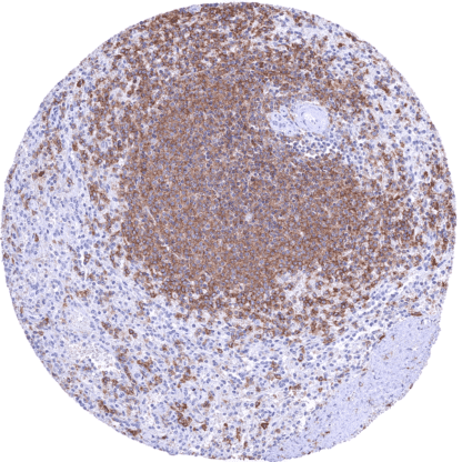 [sk1364] CD32B (HMV315)