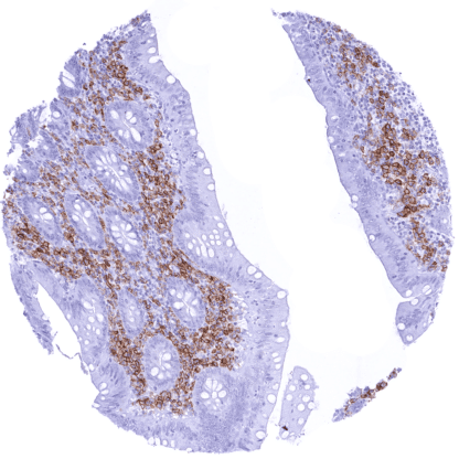 [sk1376] CD38 (MSVA-038R)