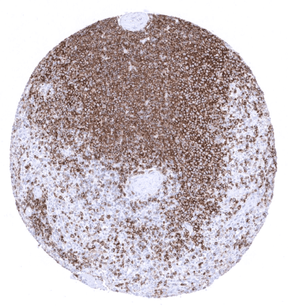 [sk1389] CD45RA (MSVA-472M)