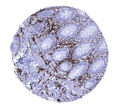 [sk1393] CD56 (MSVA-056R)