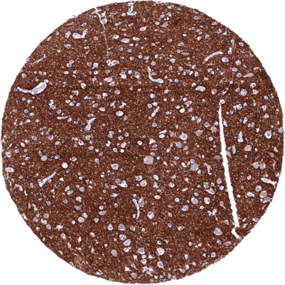 [sk1401] CD171 (MSVA-171R)