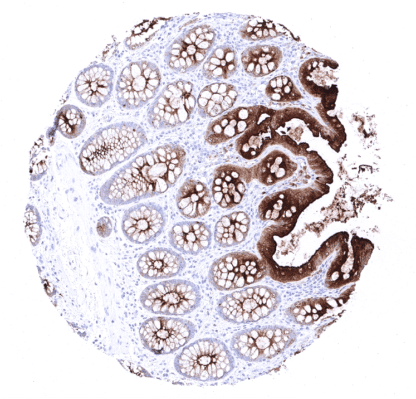 [sk1405] CEA / CD66e / CEACAM5 (MSVA-465R)