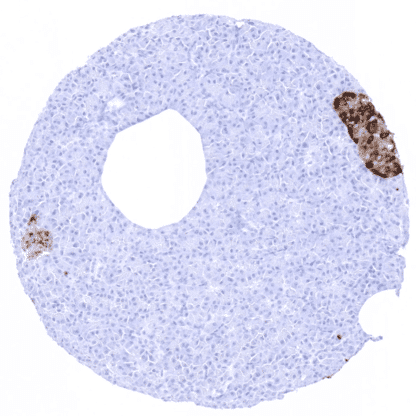 [sk1410] Chromogranin A (MSVA-380R)