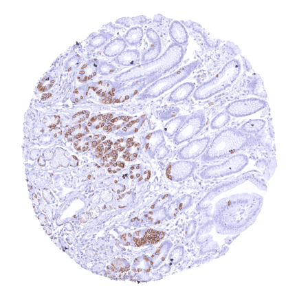 [sk1415] Claudin 3 (HMV309)