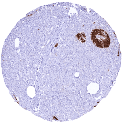 [sk1419] C-Peptide (HMV363)