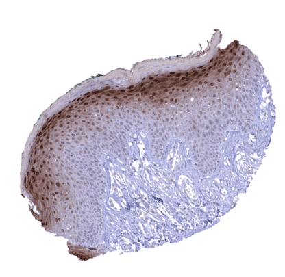 [sk1430] Cystatin A (MSVA-461M)